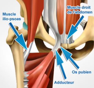 D Finition De La Pubalgie Pubalgie Traitement Pubalgies